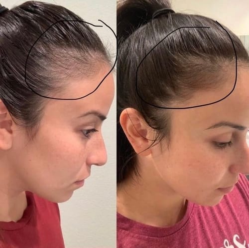 Customer photo review of IZABELL ROLLER - For eyebrows