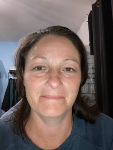 Customer photo review of F-Balm - Premium Anti-aging Tallow Balm - 2 oz.