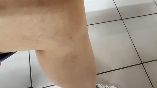 Customer photo review of 【限量現貨發售】Ulike Swift 7藍寶石冰點無痛脫毛儀-限時團購