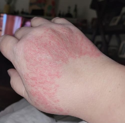 Customer photo review of Grass Fed Tallow & Honey Balm