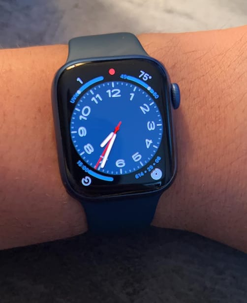 Customer photo review of Stella XS Smartwatch