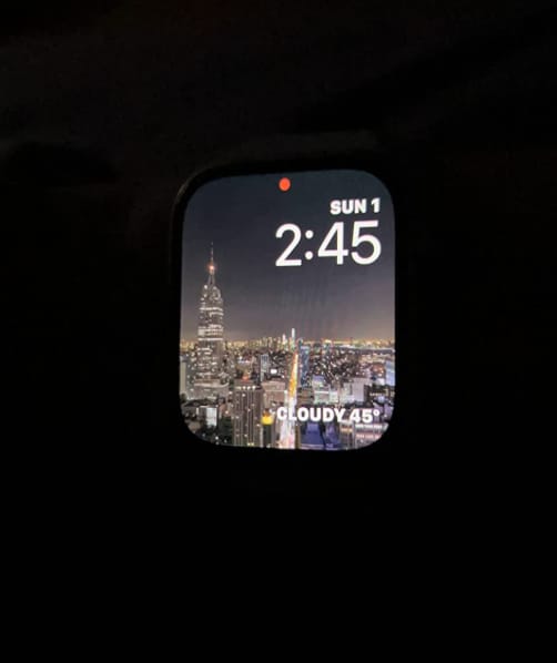 Customer photo review of Stella XS Smartwatch