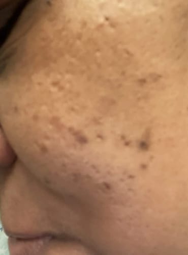 Customer photo review of Vitamin C Whitening Kit For Women