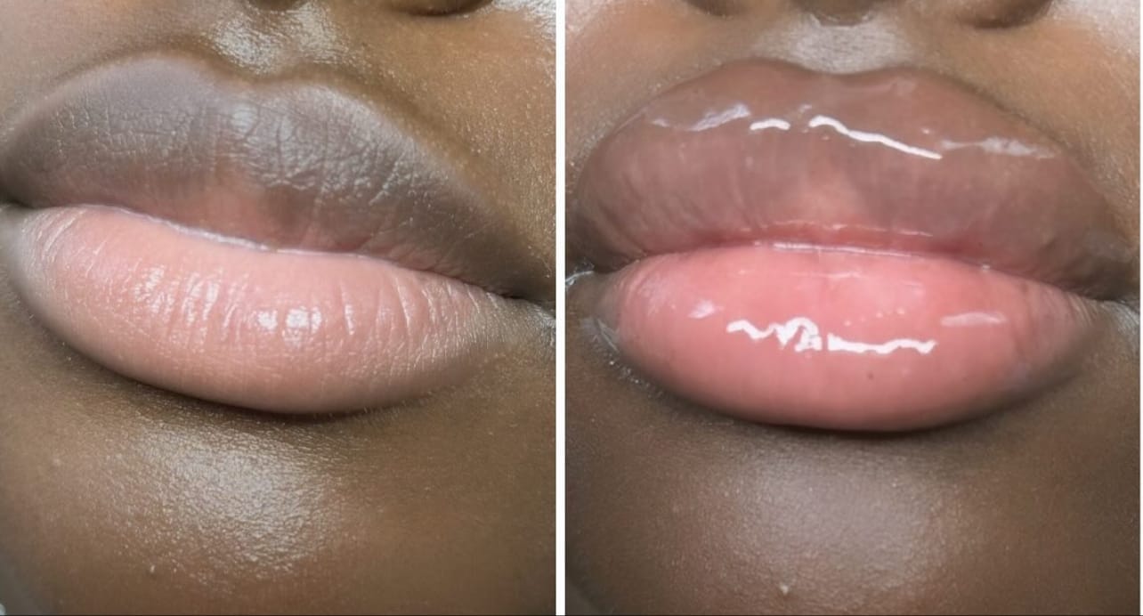 Customer photo review of Plumping Lip filler