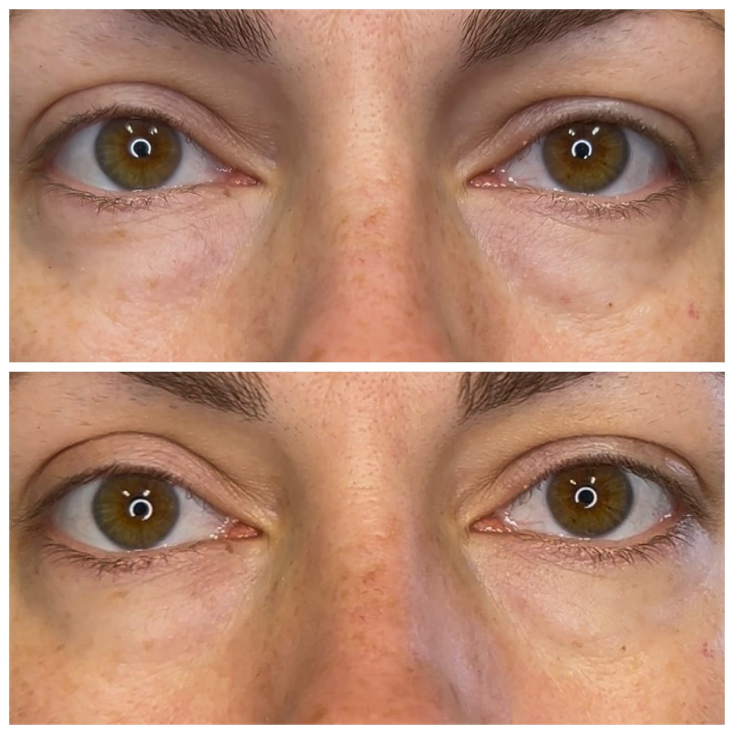 Customer photo review of Ecume - Patchs anti-cernes