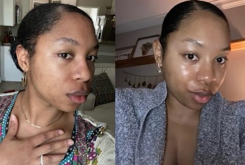 Customer photo review of Vitamin C Whitening Kit For Women