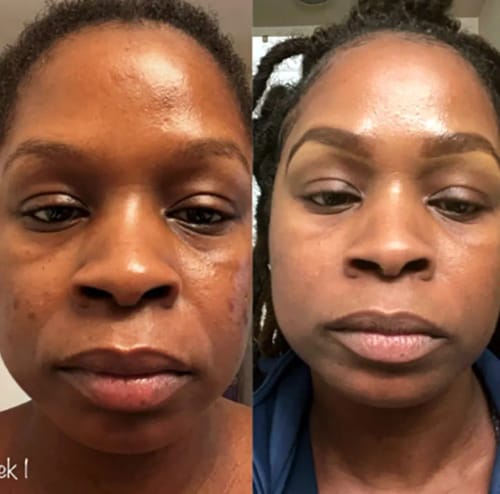 Customer photo review of Vitamin C Whitening Kit For Women
