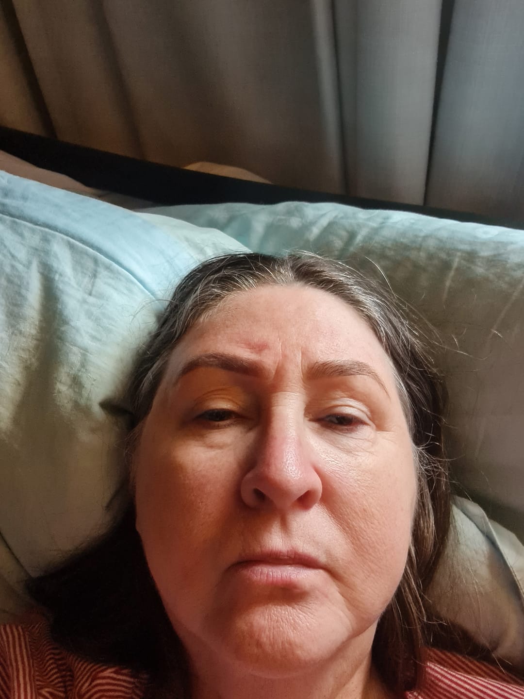 Customer photo review of Ageless AHA Glow Concentrate
