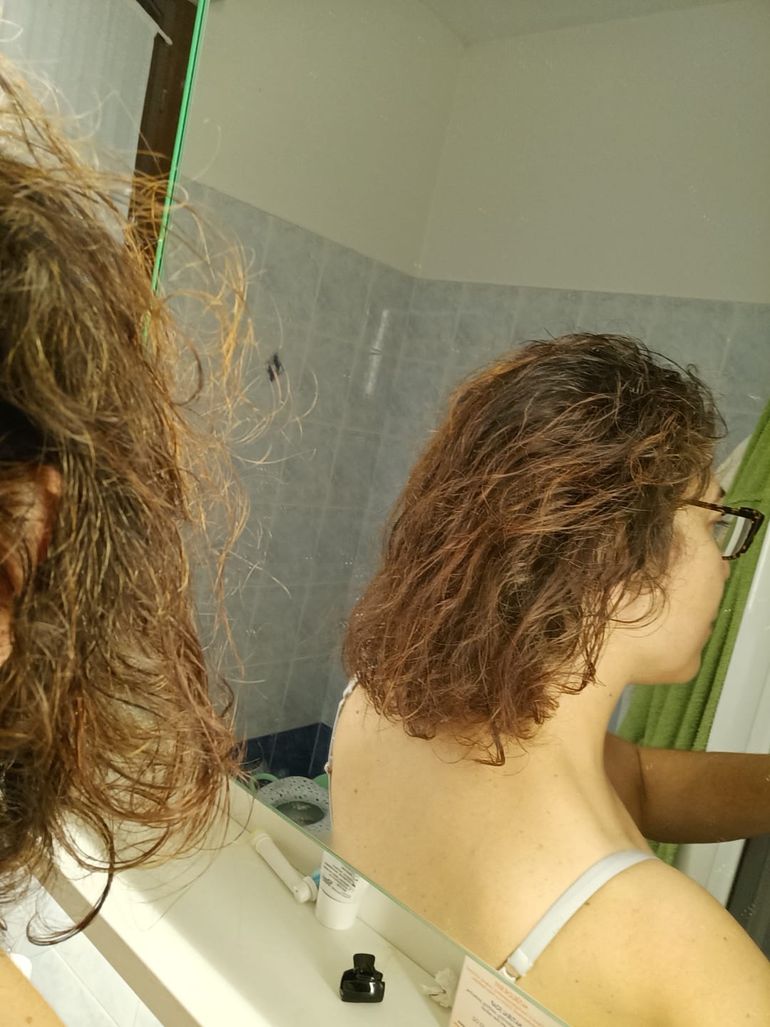 Customer photo review of Hair Growth Kit