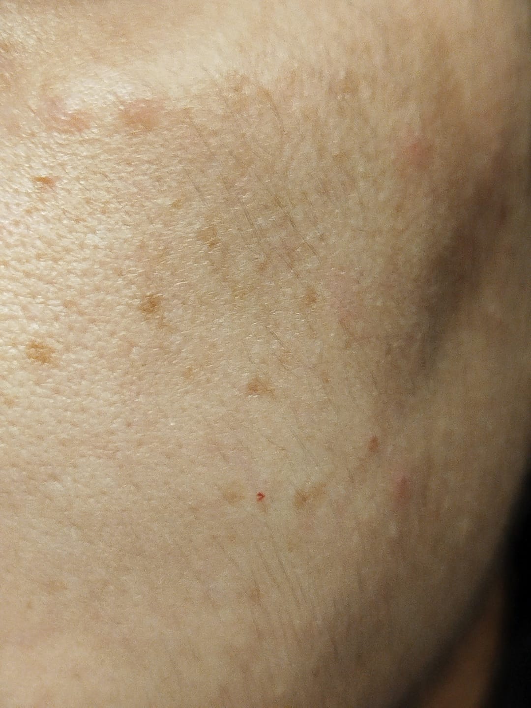 Customer photo review of Cerulic Glow Boosting Serum