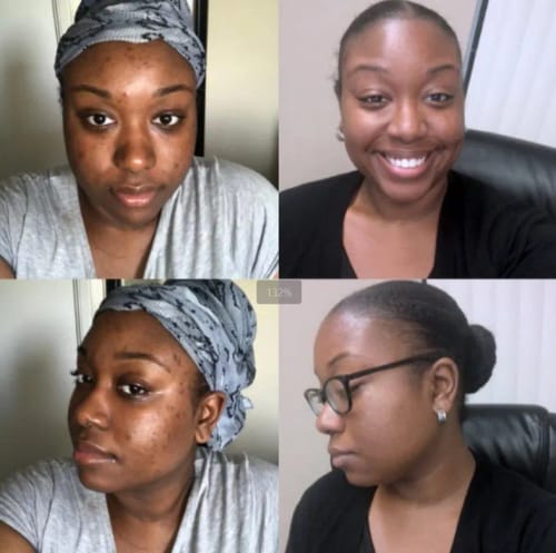 Customer photo review of Vitamin C Whitening Kit For Women