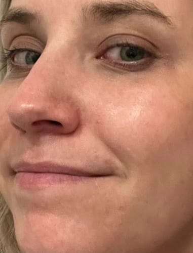 Customer photo review of Whitening Moisturizing Hydration Facial Mask