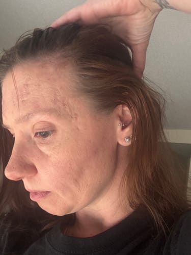 Customer photo review of Pre-Wash Scalp Oil by TR