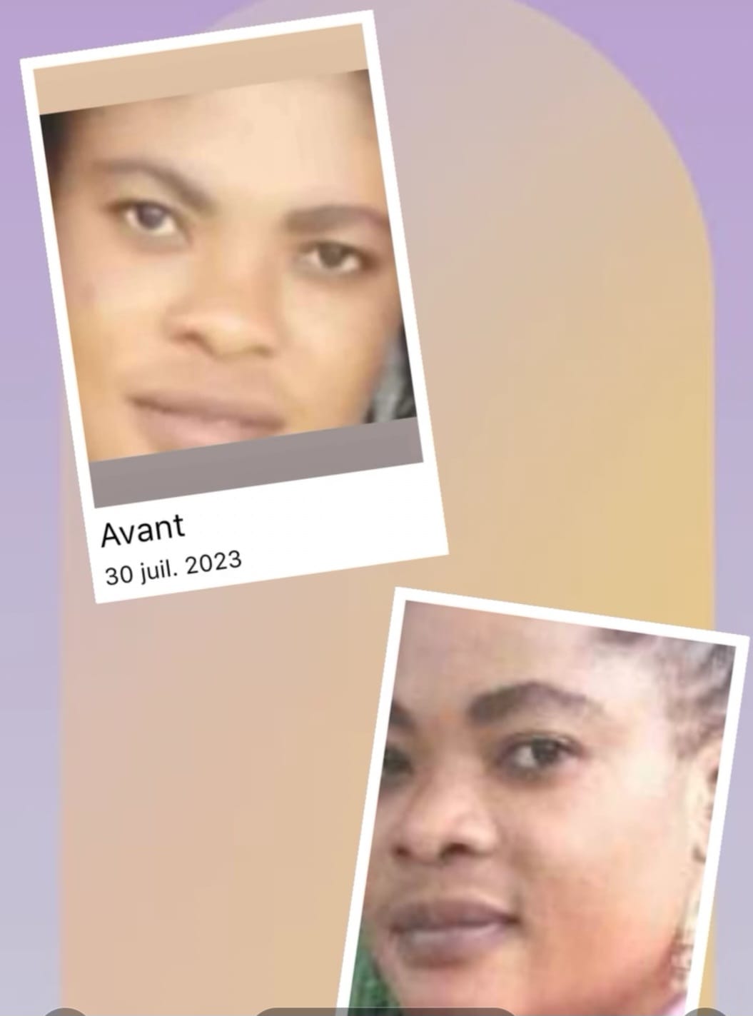 Customer photo review of Carotis Skin Brightening Cream 50g / 1.7 fl oz
