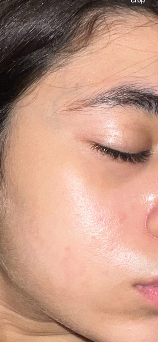 Customer photo review of Golden Glow Mask