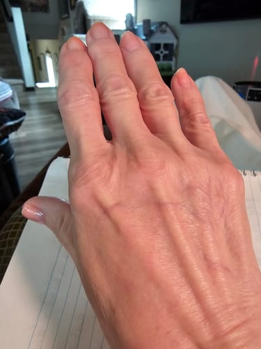 Customer photo review of Grass Fed Tallow & Honey Balm