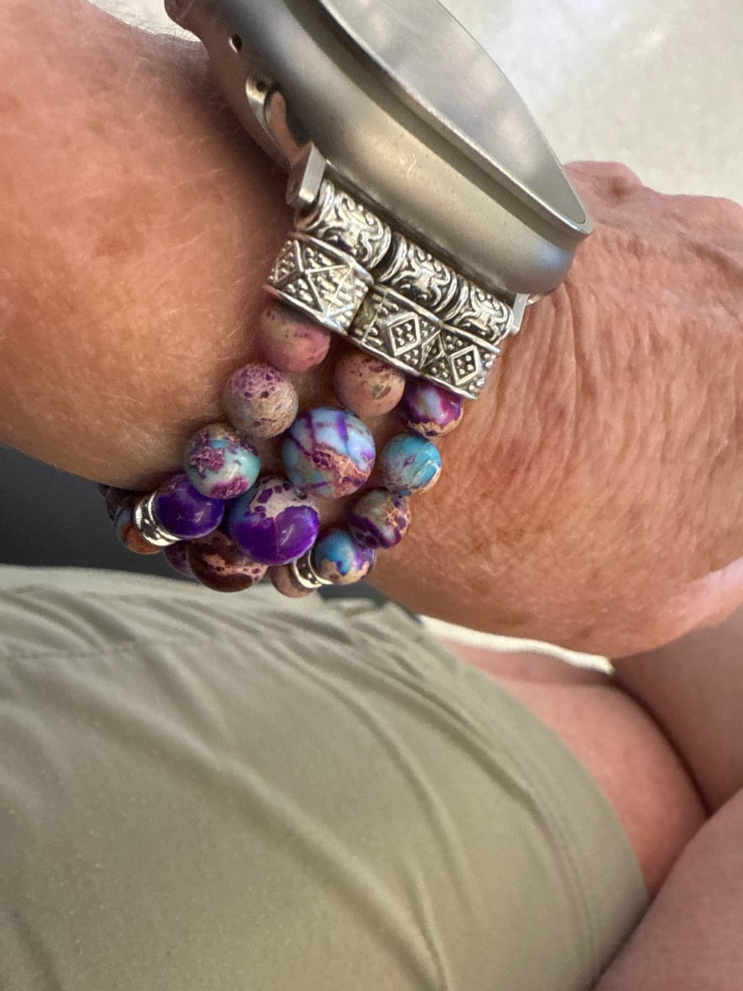Customer photo review of Intense Jasper Stretch Apple Watch Strap