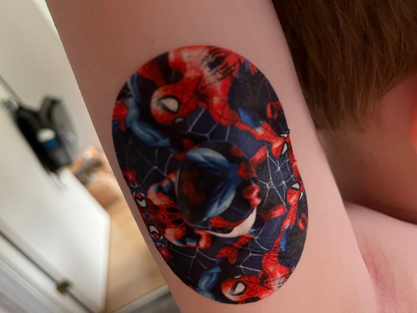 Customer photo review of Spiderman CGM-Sensor Overpatch för Dexcom G7 – inkl. Sensor Sticker