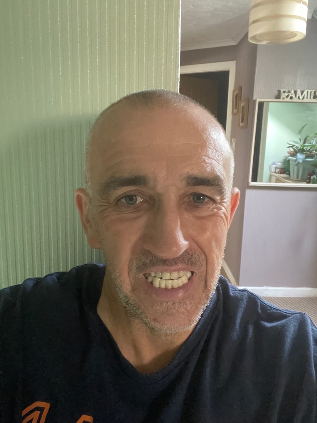 Customer photo review of Click-in Veneers 4.0