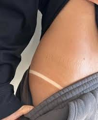 Customer photo review of Intensive Tanning Balm