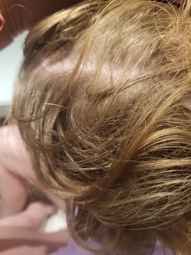 Customer photo review of Seb Natural Calming Serum