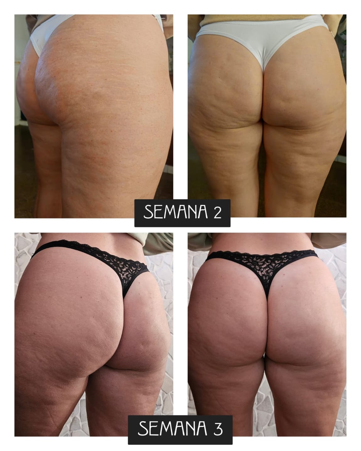 Customer photo review of Crema AntiCelulitis🧴🦵 - 200ml EMILY
