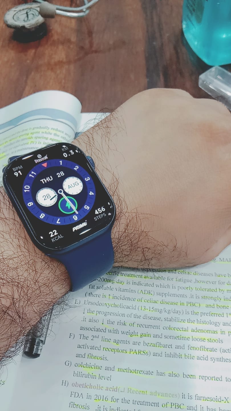 Customer photo review of Primo Smartwatch