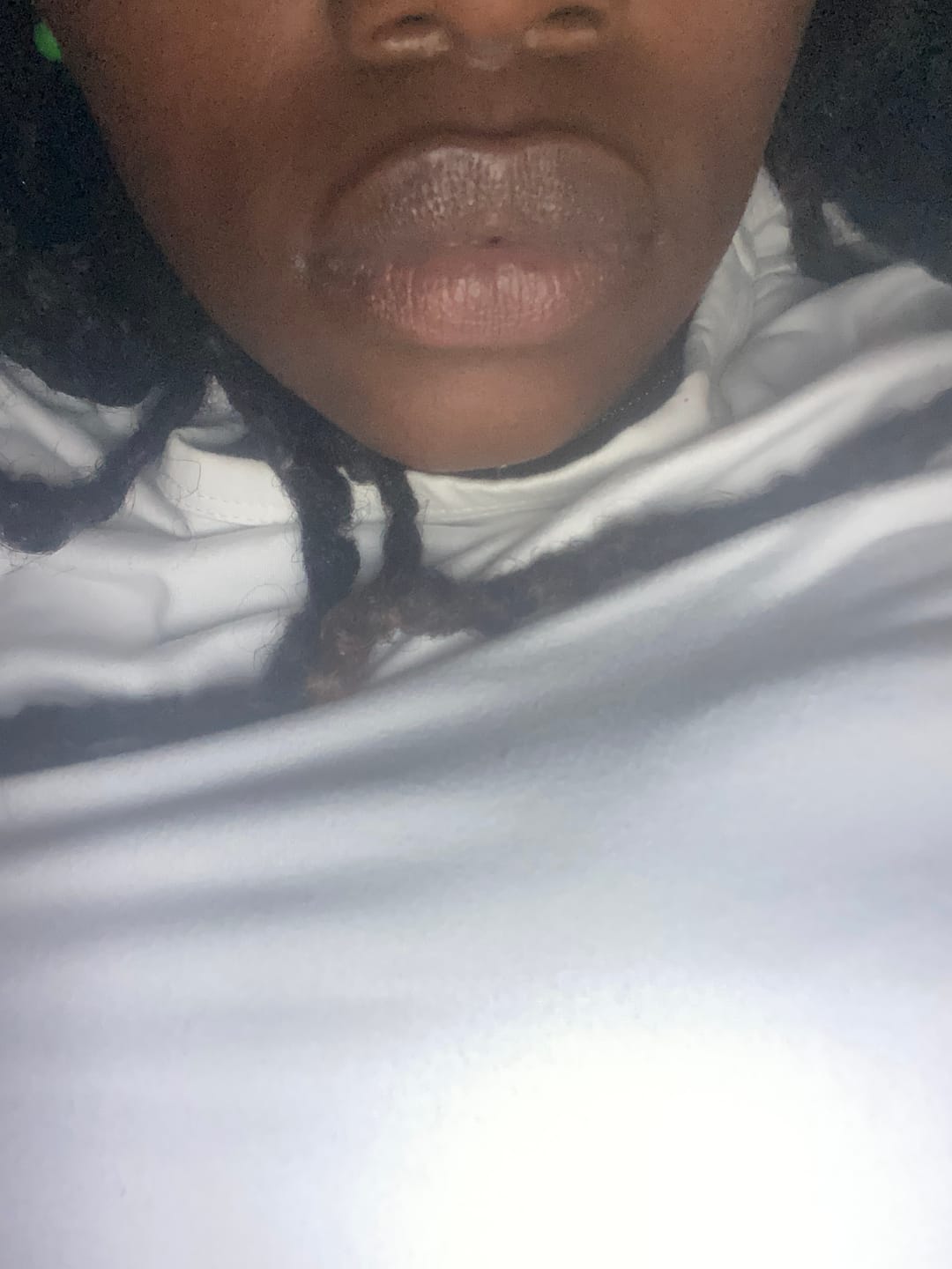 Customer photo review of Lips Lightening Cream For Men and Women (Results in 5 Days or Less)