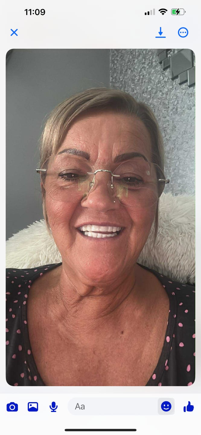 Customer photo review of Click-in Veneers 4.0