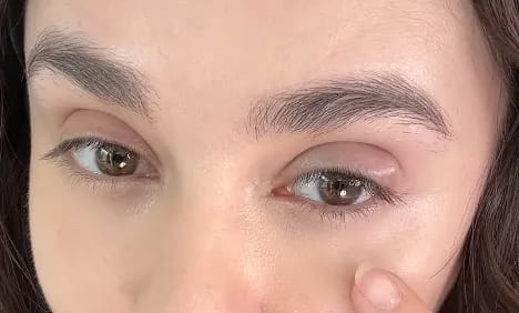 Customer photo review of Orvella™ Multi Balm