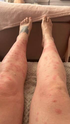 Customer photo review of Calm Balm