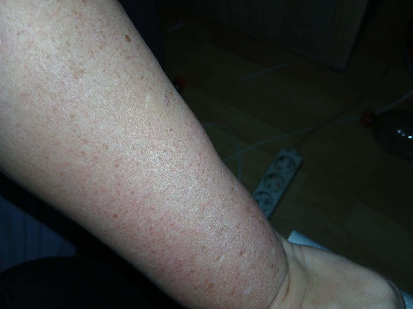 Customer photo review of 5x Belle Body Haarentfernung inkl. Gratis Enthaarungscreme
