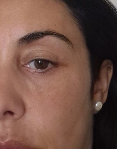 Customer photo review of Sérum de Exosomas Ultra Rejuvenecedor con Bioexosomas de Bakuchiol