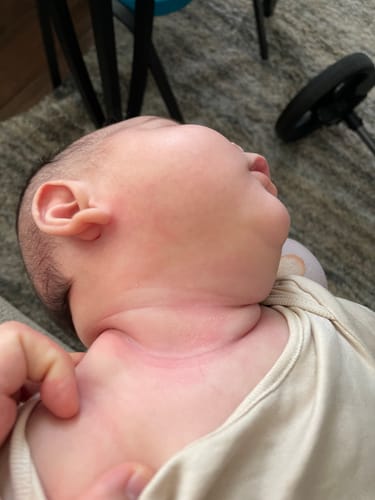 Customer photo review of All Over Ointment Original