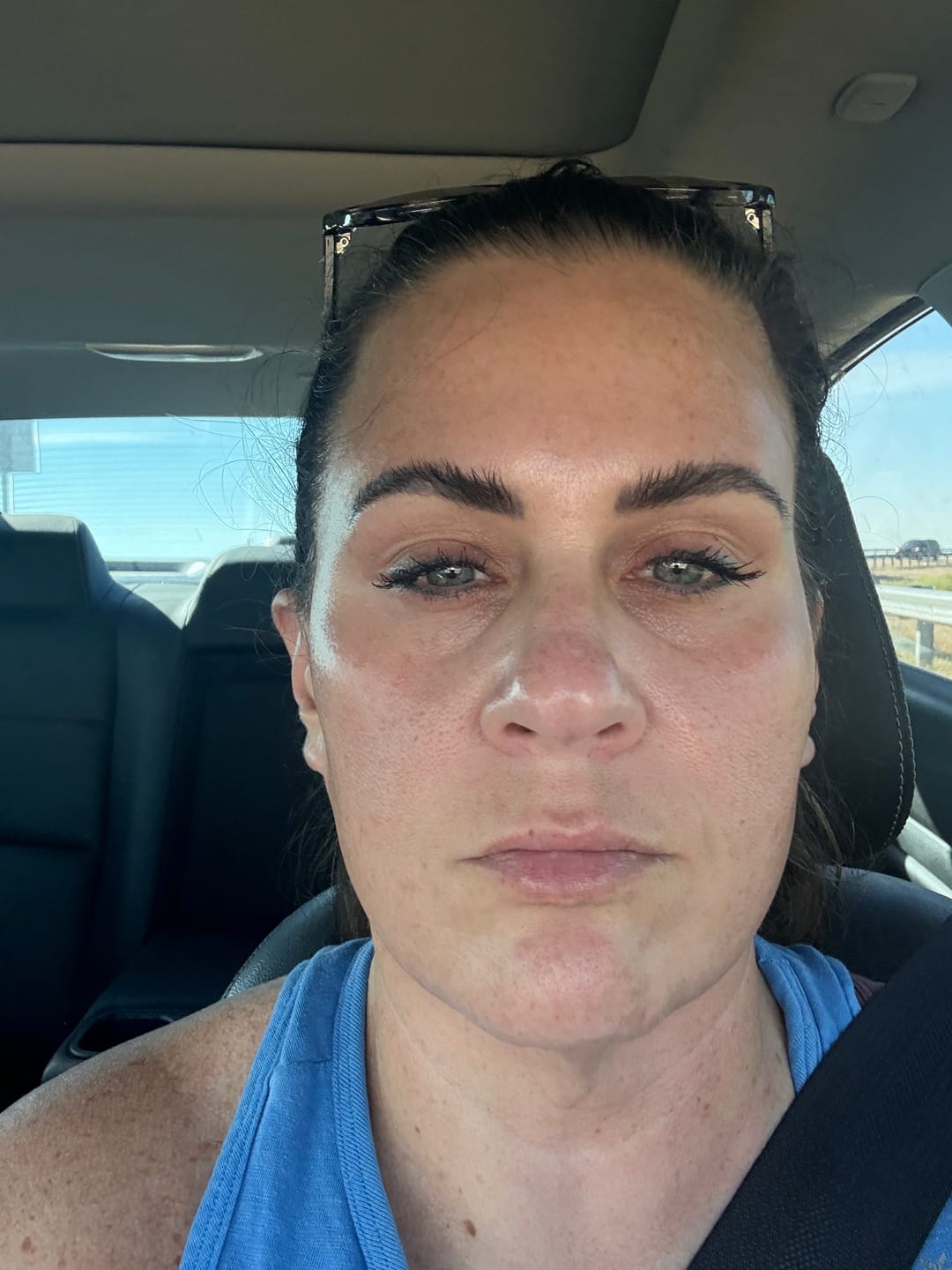 Customer photo review of RHF 24K Nano Gold Basal Repair Serum +++