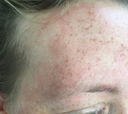 Customer photo review of Seb Natural Calming Serum