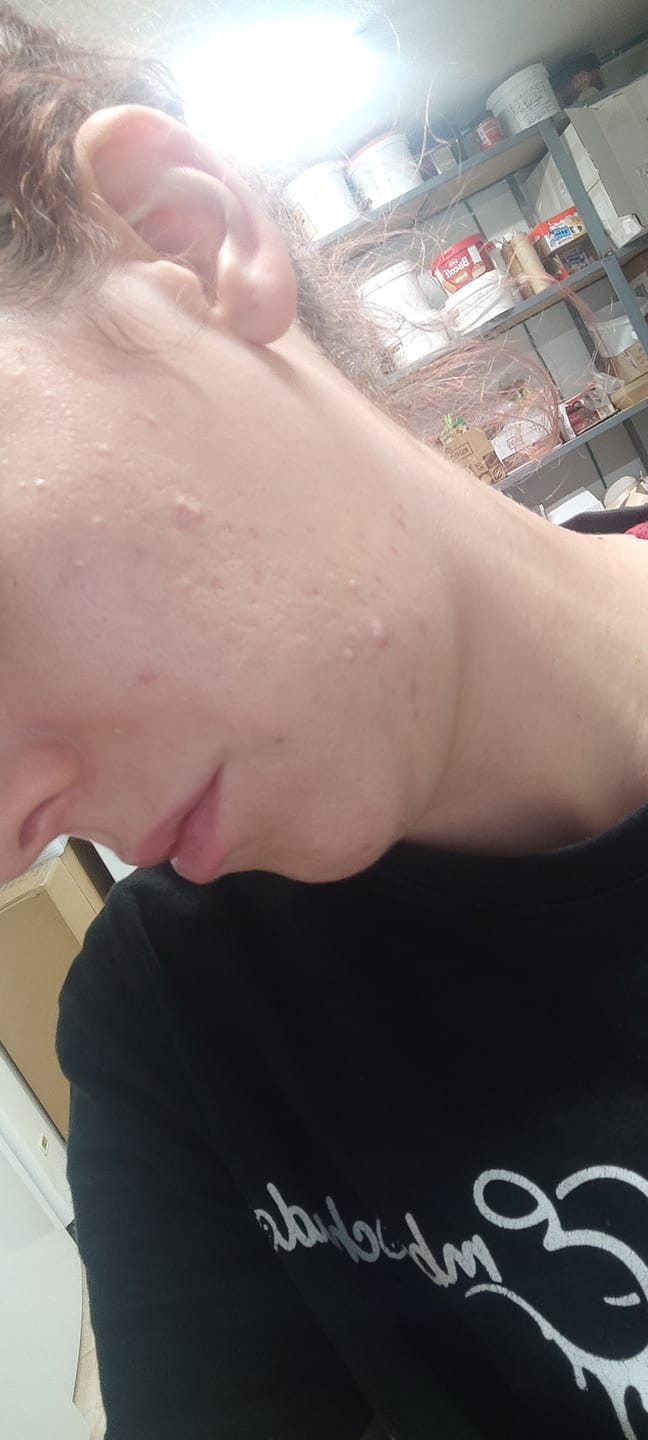 Customer photo review of A CONTROL + CORTIZEN - Equilibrio hormonal desde el cerebro, los ovarios, la piel y el metabolismo.