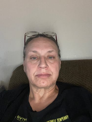 Customer photo review of Grass Fed Tallow & Honey Balm