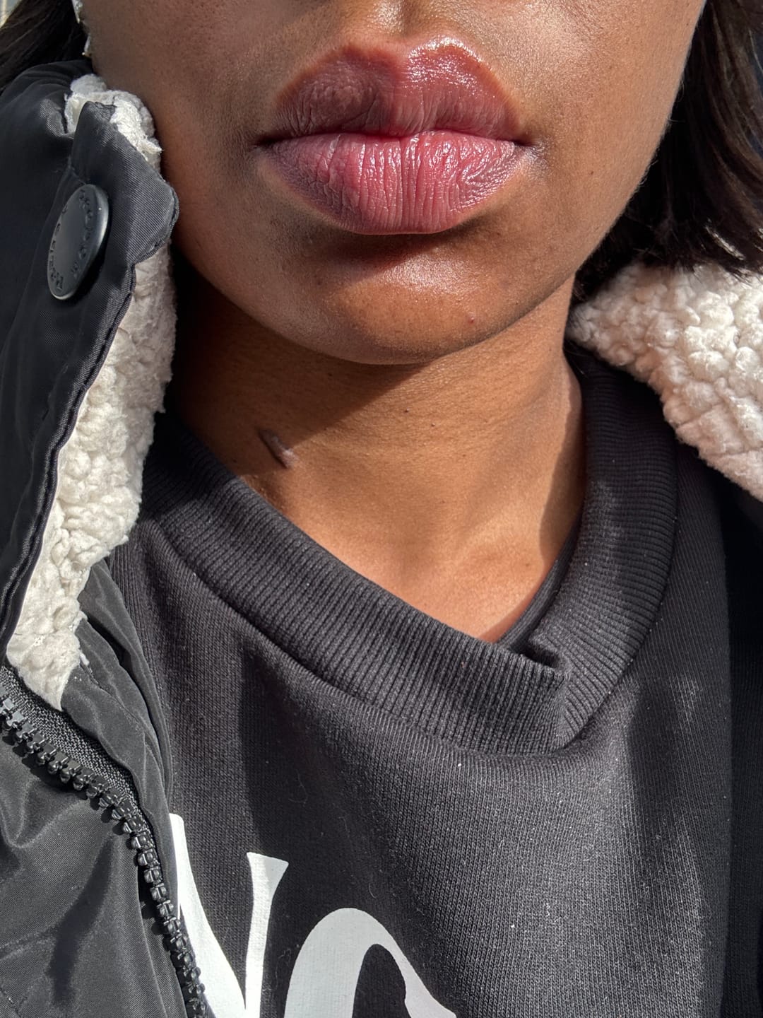Customer photo review of Lips Lightening Cream For Men and Women (Results in 5 Days or Less)