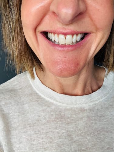 Customer photo review of Bestseller Duo (Peach + Apple & Kiwi)