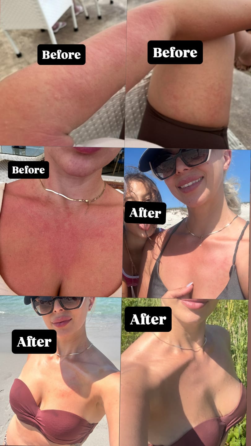 Customer photo review of Sol+3 and AGR+E Day & Night Set