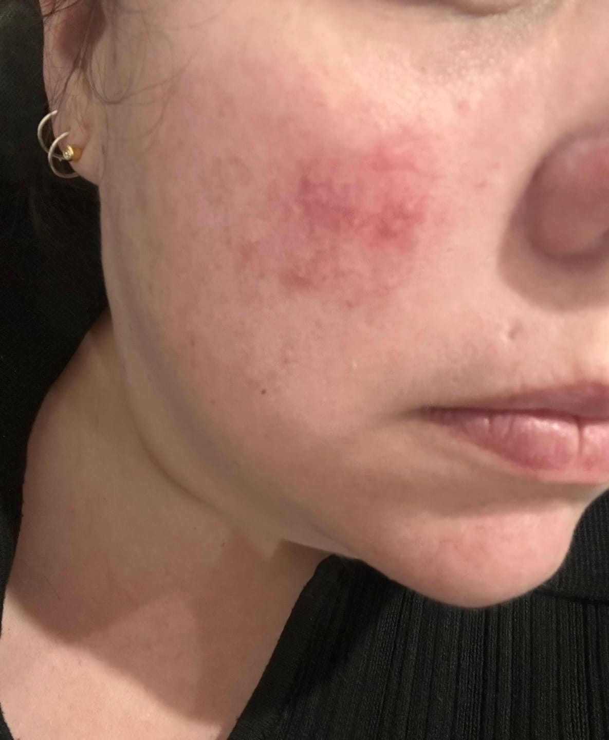 Customer photo review of ⚡ Turmeric Vitamin C Clay Mask
