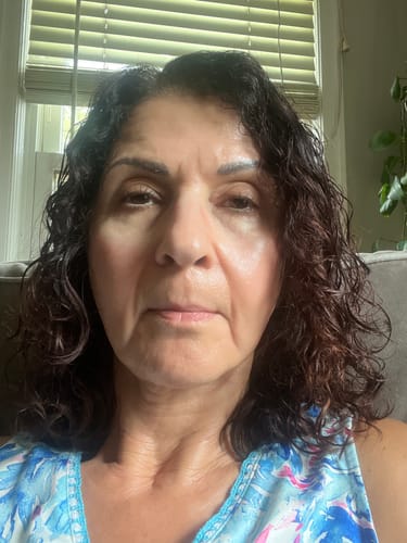 Customer photo review of EvenSkyn® Lumo⁺ (2025) Skin Tightening Handset