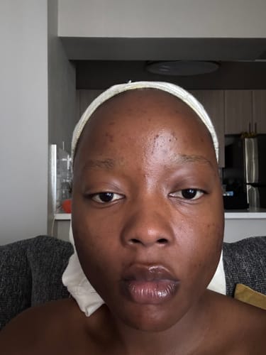 Customer photo review of Dark spots + Glow combo