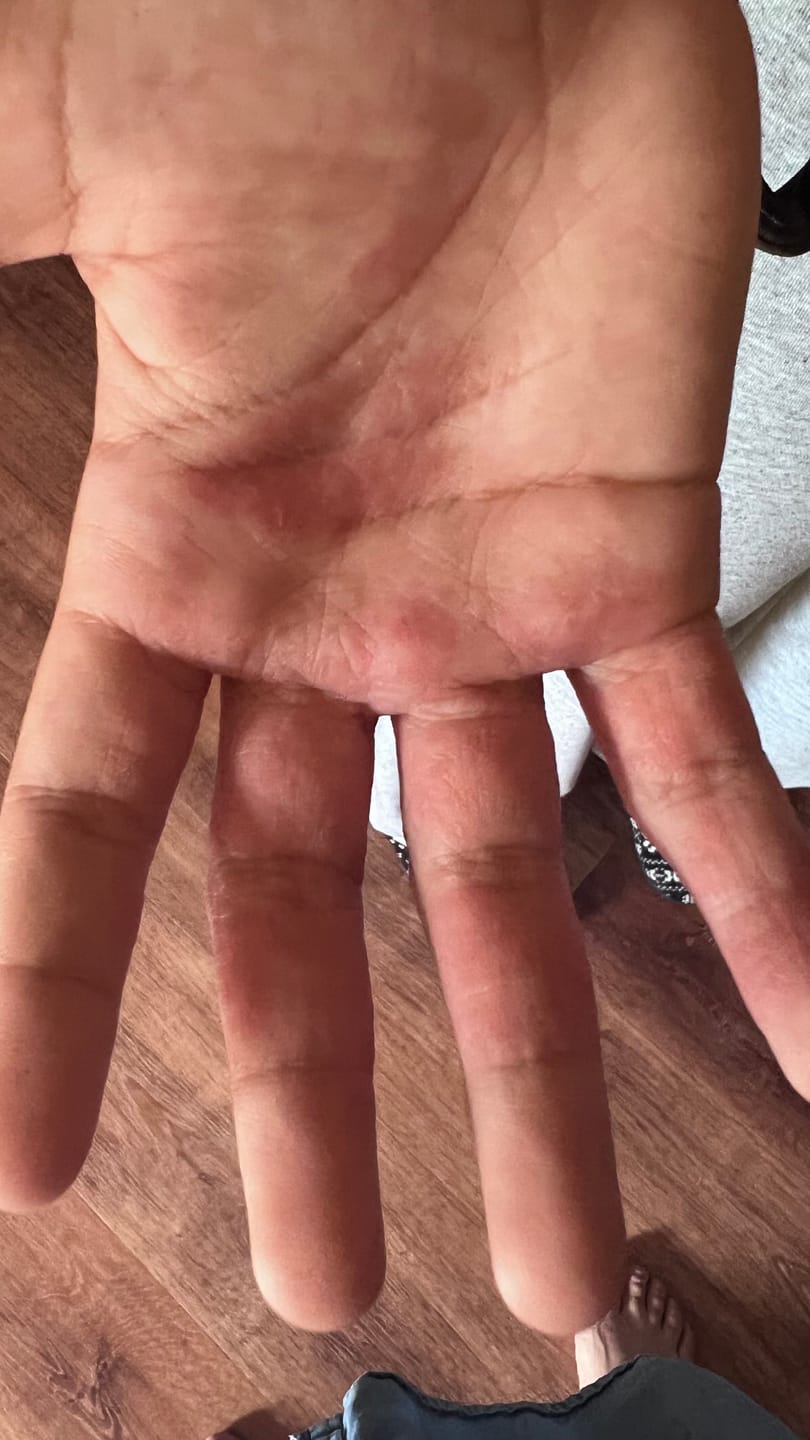 Customer photo review of Prebiotic Hand Cream