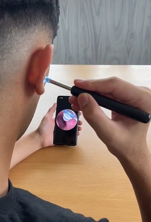 Customer photo review of Luxloom - Ohrenreiniger mit HD-Kamera