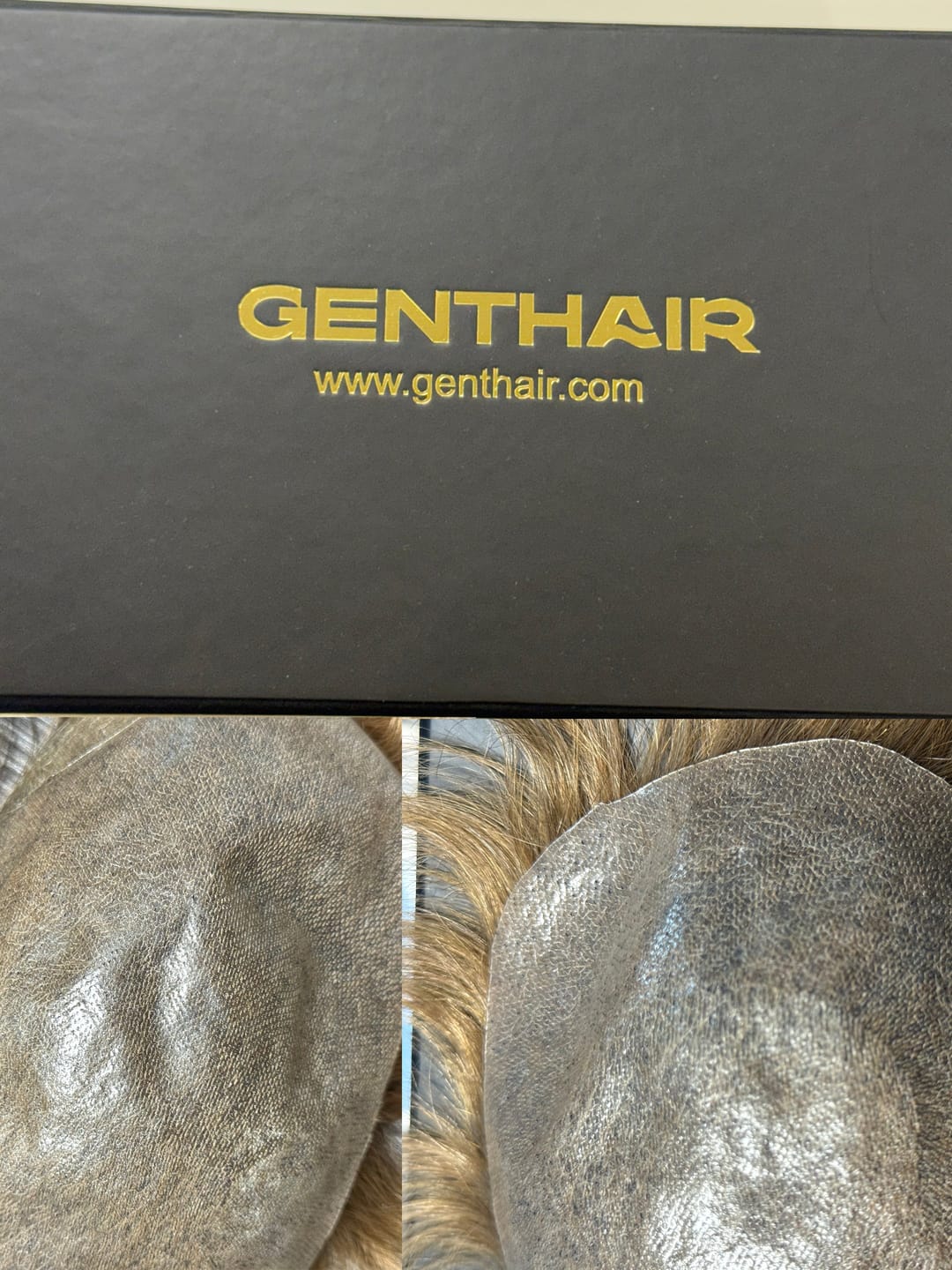 Customer photo review of Men Hair Pieces Victor|V-loop 0608mm Ultra-thin skin base