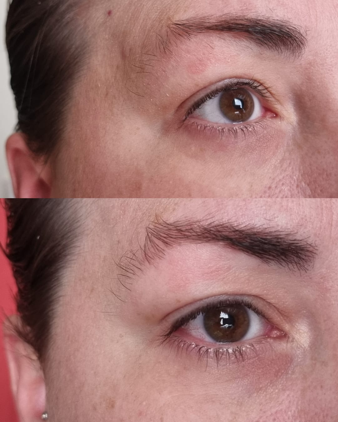 Customer photo review of Global Eye & Lip Care
