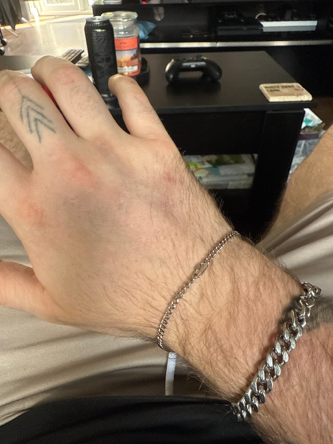 Customer photo review of 🎁 Permanent Bracelet Cleaner Kit (100% off)