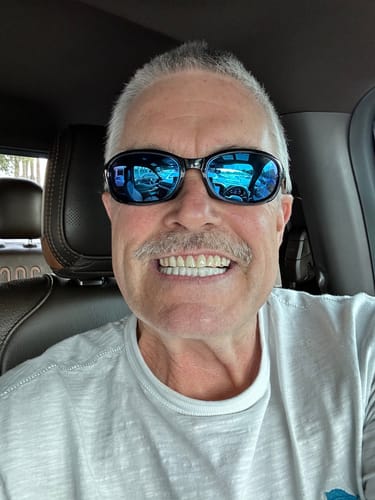 Customer photo review of [SST] Spare Veneers